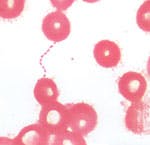 Mlo0903cliniss1 Mlo0903cliniss1