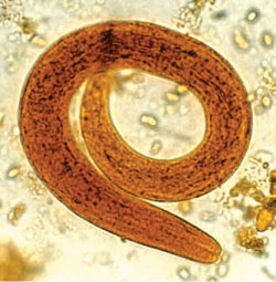 a strongyloidosis helmintus
