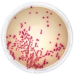 Special Feature Chromogenic Medium Special Feature Chromogenic Medium