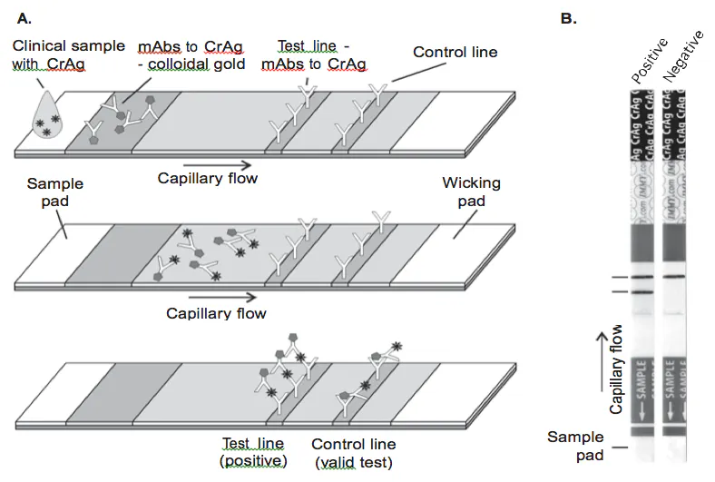 Lab Test Ccg Sensitivity and specificity of a new cryptococcal antigen lateral flow ...