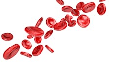 Mlo Generic Bloodworks1 Mlo Generic Bloodworks1