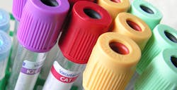 Mlo Generic Bloodtesttubes Mlo Generic Bloodtesttubes