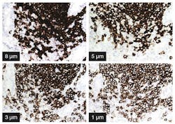 Dako Figure 1 Adding Quality To Your Qualitative Ihc 1024x728 Dako Figure 1 Adding Quality To Your Qualitative Ihc 1024x728