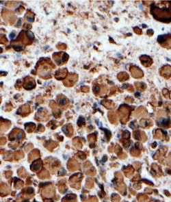 Dako Figure 2 Fi Adding Quality To Your Qualitative Ihc Dako Figure 2 Fi Adding Quality To Your Qualitative Ihc