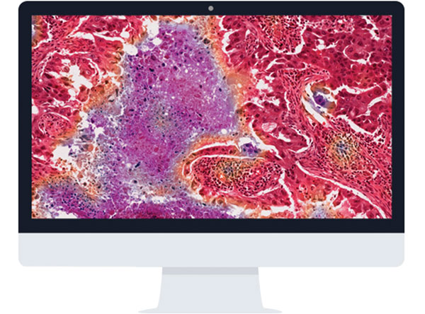 Mlo201605 Clinical Corista