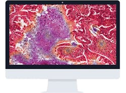 Mlo201605 Clinical Corista Mlo201605 Clinical Corista