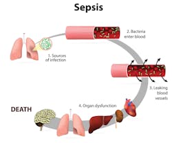 Mlo201606 Clinical Issues Sepsis Art Mlo201606 Clinical Issues Sepsis Art