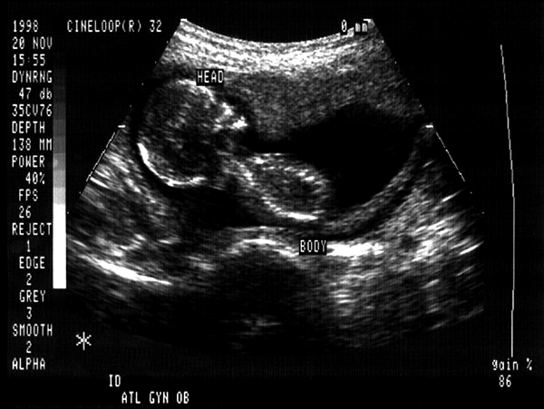 Mlo201608 Education Art2