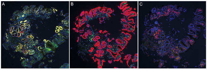 Mlo201608 Spec Feature Fig1