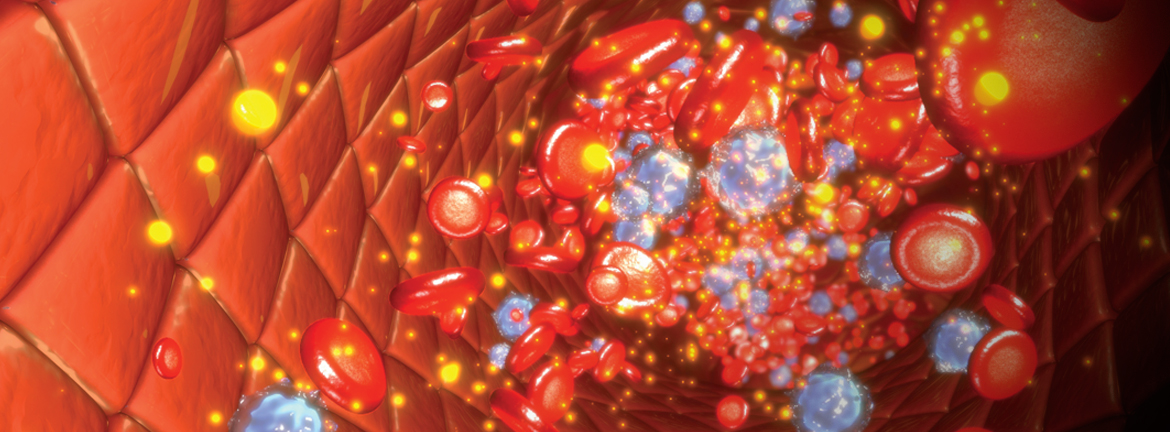 Sepsis and the hematology laboratory Medical Laboratory Observer