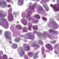 Mlo201705 Ce Story Mgenitalium