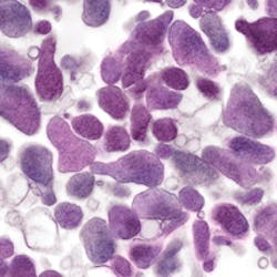 Mlo201705 Ce Story Mgenitalium Mlo201705 Ce Story Mgenitalium