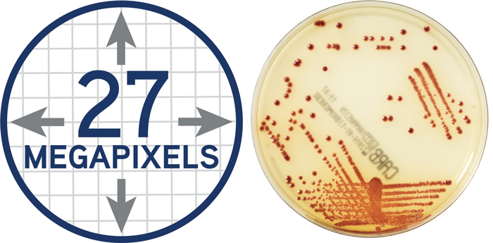 Mlo201705 Education Digitized Plate Reading