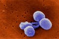 MagArticle_Streptococcuspneumoniae