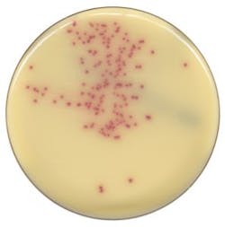 Mlo201708 Lab Mgmt Copan Fig1 297x300 Mlo201708 Lab Mgmt Copan Fig1 297x300