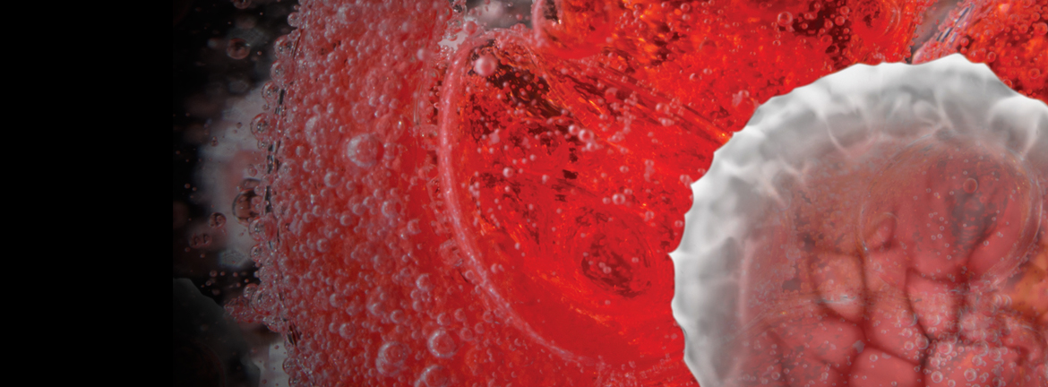 Slider1 Image Ce 0218