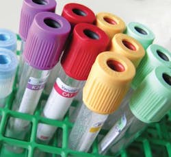 Mlo Special Feature Bio Rad2 Tubes 300x275 Mlo Special Feature Bio Rad2 Tubes 300x275