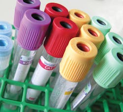 Mlo Special Feature Bio Rad2 Tubes Mlo Special Feature Bio Rad2 Tubes