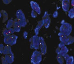 Mlo201804 Online Exclusive Carolinas Fig1 300x260 Mlo201804 Online Exclusive Carolinas Fig1 300x260