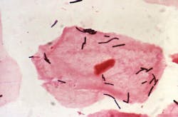 Mlo201805 Spec Feat Quest Art Mlo201805 Spec Feat Quest Art