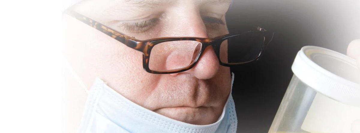 Legal Liability In Urine Drug Testing Could Your Lab Be Exposed Medical Laboratory Observer