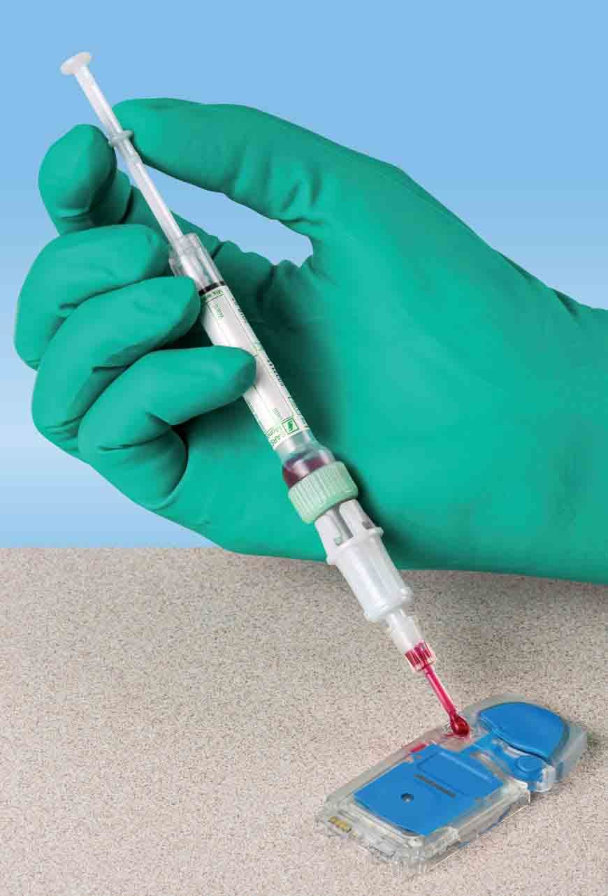 Prod Focus Sarstedt Monovette Poc On Blue 2