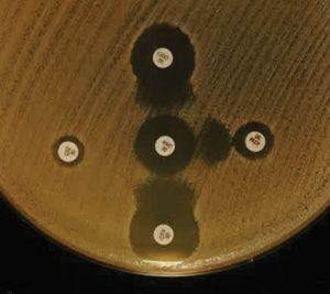 Mlospfe Image1 300x267