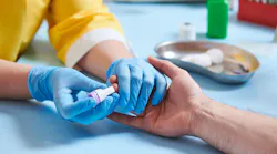 Blood test. Medicine. Piercing male finger for blood examitation analysis.
