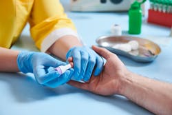 Blood test. Medicine. Piercing male finger for blood examitation analysis. Blood test. Medicine. Piercing male finger for blood examitation analysis.