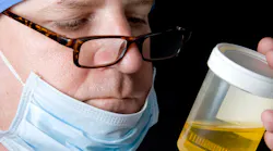 A doctor examining a fresh urine specimen.