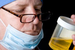 A doctor examining a fresh urine specimen.