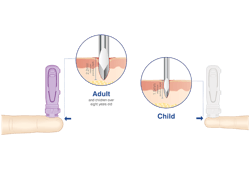 Selecting lancet length Selecting lancet length