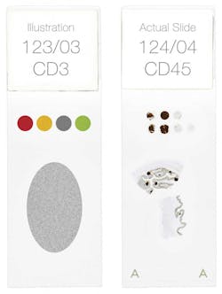 Dako Figure 3 Adding Quality To Your Qualitative Ihc 771x1024 Dako Figure 3 Adding Quality To Your Qualitative Ihc 771x1024