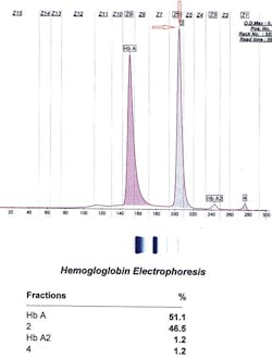Fig 2 G Phillly Mlo0001 Fig 2 G Phillly Mlo0001