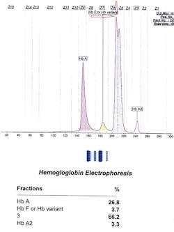 Fig 3 D La Mlo0001 Fig 3 D La Mlo0001