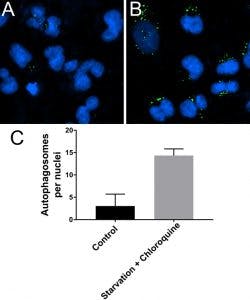 Figure2 Autophagy Basic Figure 250x300 Figure2 Autophagy Basic Figure 250x300