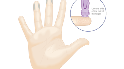 Finger puncture site selection