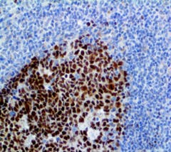 L01 Art Assay 151 L01 Art Assay 151