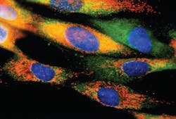 Cellular Cytomegalovirus Infection as indicated by the red spots Cellular Cytomegalovirus Infection as indicated by the red spots