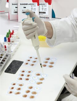 Mlo201604 Product Focus Randox Hhh2025 Aso Mlo201604 Product Focus Randox Hhh2025 Aso