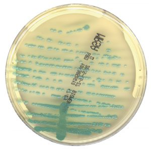 Mlo201708 Lab Mgmt Copan Fig2 300x296