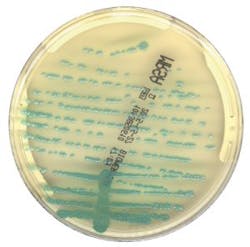 Mlo201708 Lab Mgmt Copan Fig2 300x296 Mlo201708 Lab Mgmt Copan Fig2 300x296