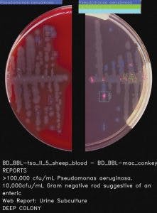 Mlo201708 Lab Mgmt Copan Fig3 221x300 Mlo201708 Lab Mgmt Copan Fig3 221x300