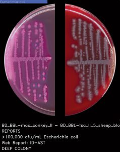Mlo201708 Lab Mgmt Copan Fig4 238x300