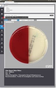 Mlo201708 Lab Mgmt Copan Fig6 190x300 Mlo201708 Lab Mgmt Copan Fig6 190x300