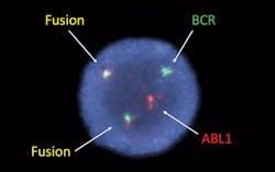 Mlo201709 Future Buzz Fig2 Mlo201709 Future Buzz Fig2