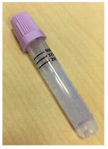 Mlo201711 Spec Rep Sheikh Khalifa Fig2 217x300 Mlo201711 Spec Rep Sheikh Khalifa Fig2 217x300