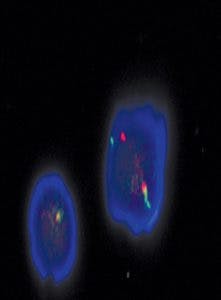 Mlo201804 Online Exclusive Carolinas Fig2 221x300 Mlo201804 Online Exclusive Carolinas Fig2 221x300