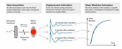 Figure 2. Sonorheometry analysis. Figure 2. Sonorheometry analysis.
