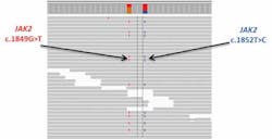 Figure 2. Targeted sequencing of an MPN sample clearly reveals the two JAK2 mutations that were missed by ddPCR. Figure 2. Targeted sequencing of an MPN sample clearly reveals the two JAK2 mutations that were missed by ddPCR.